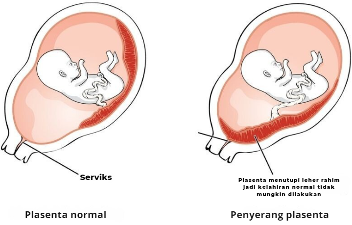 menyentuh perut ibu hamil, manfaat pijat perut, tips kehamilan, trimester ketiga, kesehatan janin, Bunda, si Kecil, Ibu Hamil